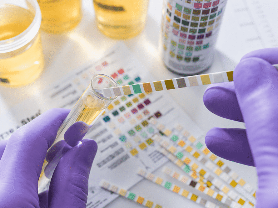 urine drug test